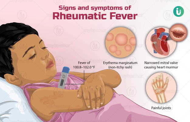 Rheumatic fever 