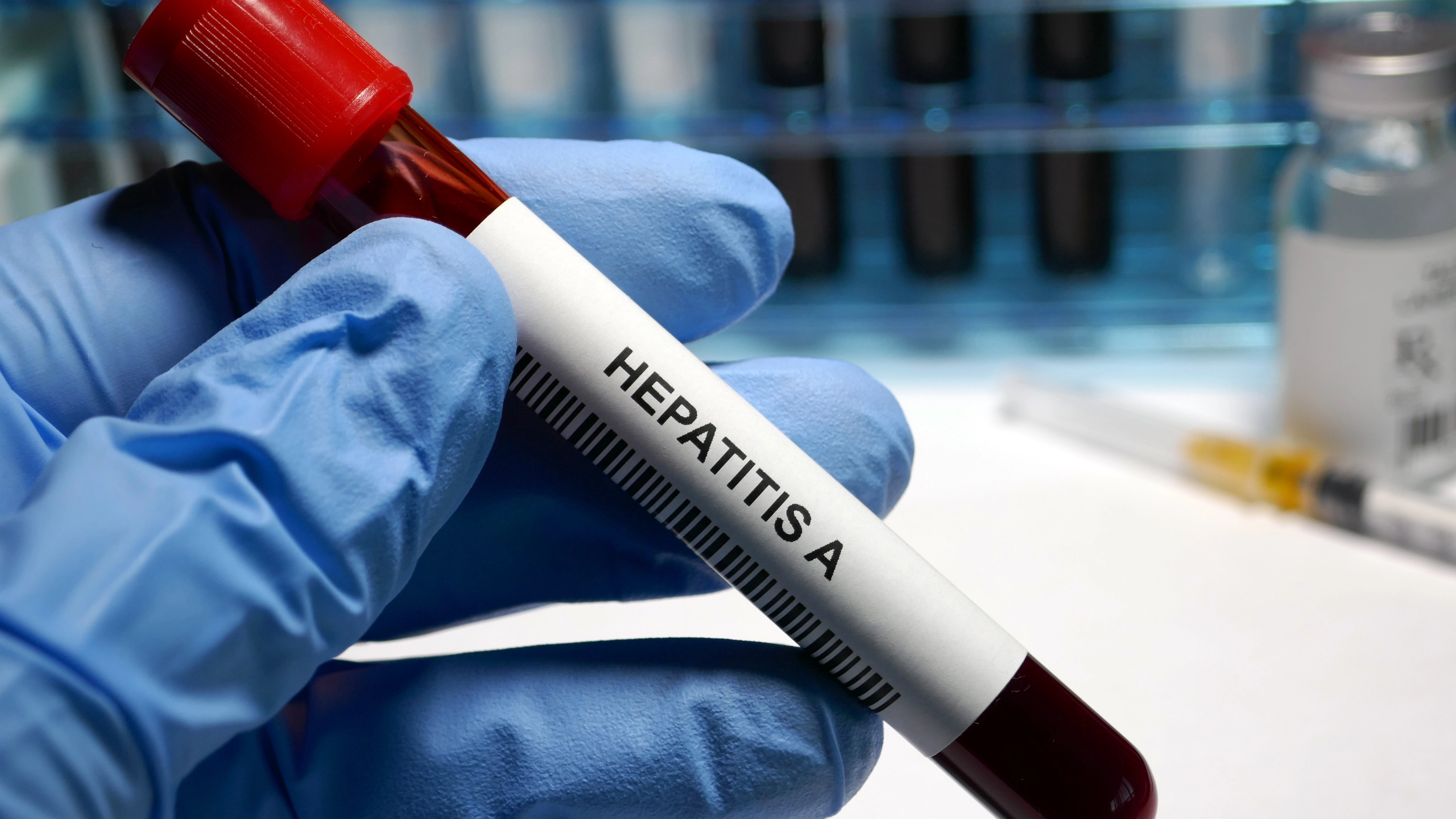 Hepatit A Virüsü Nedir?