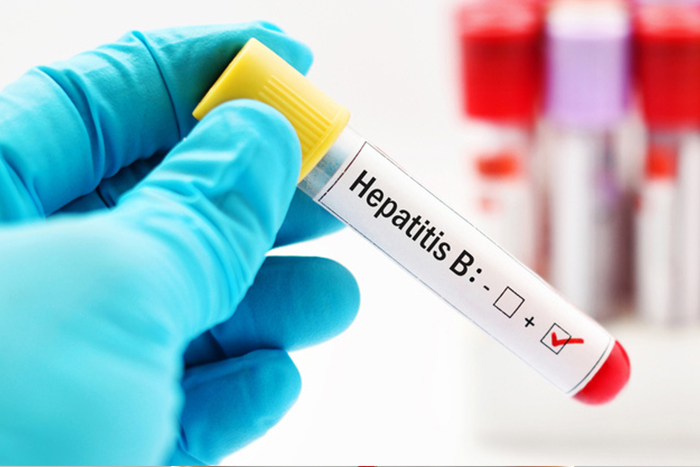 hepatit, Hepatit B, Hepatit B, Hepatit C, Hepatit D, Hepatit E